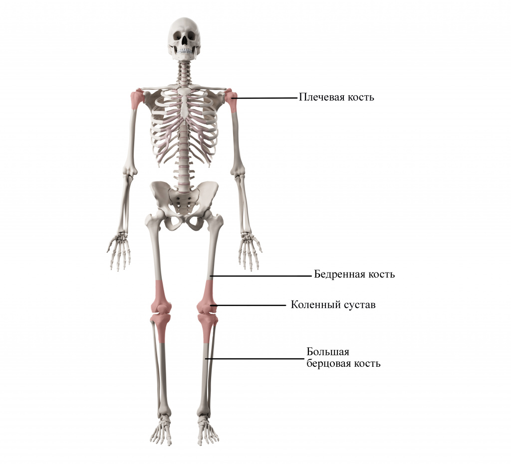 остеосаркома скелет.jpg