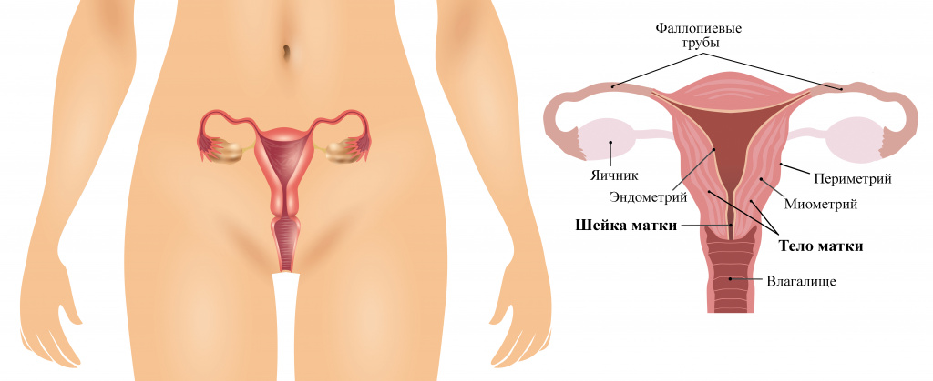 Рак шейки матки 3 стадии